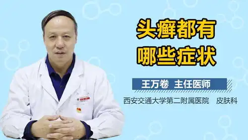 头癣的症状