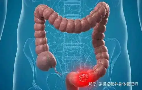  轻妃推荐丨有关便秘的自我疗法,便秘小贴士