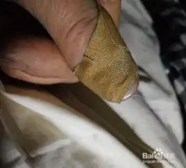  手指划伤该怎么办呢