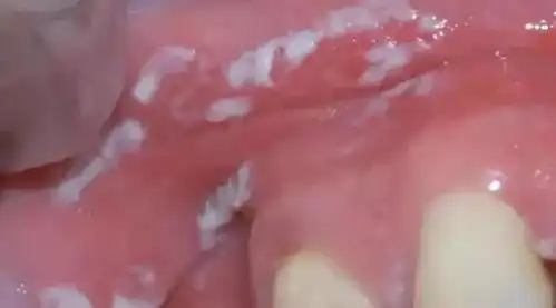  这十种常见口腔疾病,你有遇到过么