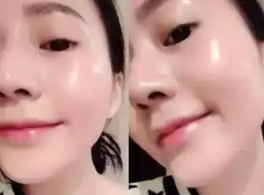  善用维生素e,睡前一小会儿,眼袋通通消失