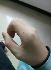  手被有点生锈的尖嘴钳划破了一点点,有事吗