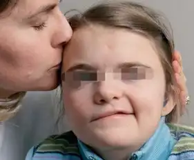  治疗小孩面瘫的偏方治疗都有哪些方法