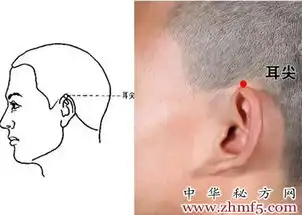  耳尖穴打印页面
