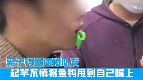  太巧浙江一男子钓鱼遇猪队友,起竿不慎将鱼钩甩到自己嘴上