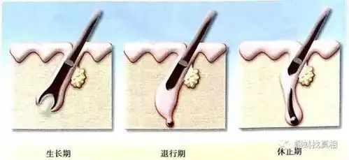  正月里困扰我的不是能不能剪头,而是秃头