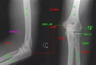  高级放射技师图像解读课程肘关节