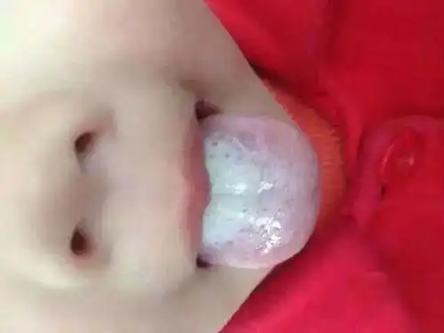  母乳喂养的宝宝是否健康,看舌苔就知道了