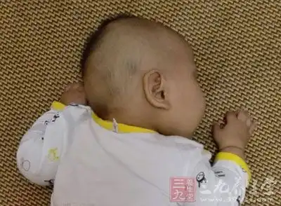  小儿咳嗽有痰怎么办咳嗽的治疗方法