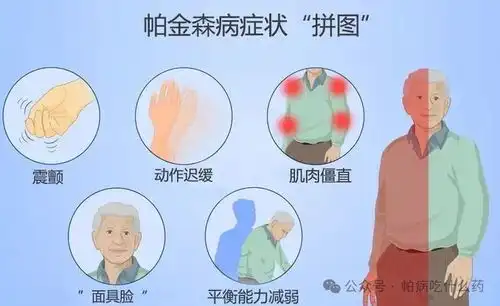  治疗帕金森的配方,不管多严重都能治必须转身边人一定需要