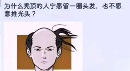  搞笑趣图为什么秃顶的人宁愿留一圈头发,也不愿意理光头