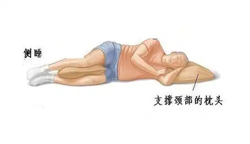 腰椎增生的正确睡姿图