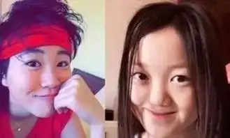  李亚鹏晒闺女李嫣最新正面照,经过3次治疗她嘴唇已无手术痕迹