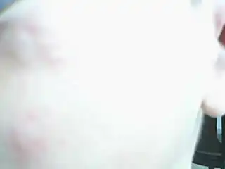  为什么6岁小孩身上长着大包还有些像蚊子咬的包还像水泡还很痒