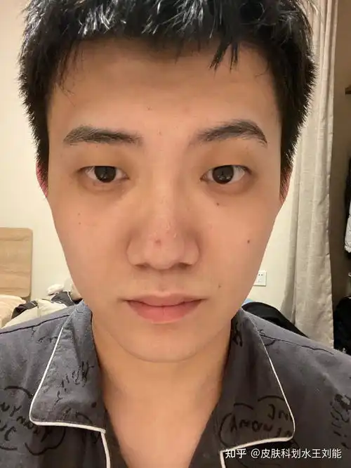  要睡多久能把黑眼圈睡没
