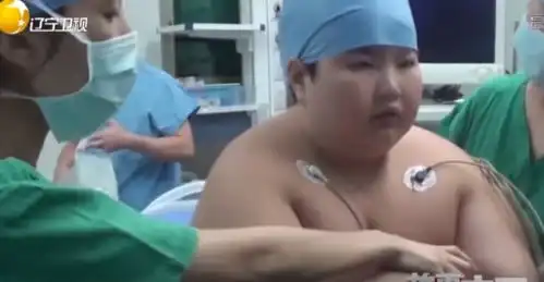  回顾14岁男孩胖到300斤,一夜吃完整箱泡面,去世前喊着要减肥