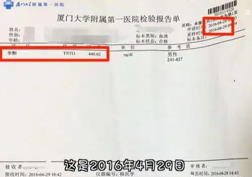 小伙健身半年,睾酮水平下降50健身的你一定要注意了