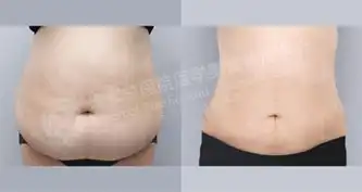 滚蛋吧,脂肪君我有最舒适的减肥方法  滚蛋吧,脂肪君我有最舒适的减肥方法