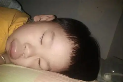  一觉醒来,儿子被蚊子咬成香肠嘴,妈妈心疼又不知所措
