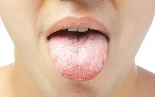  湿气重,身体会出现1黑1白,多吃这些食物,祛湿养脾胃
