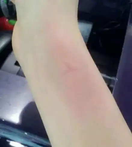  图集那些年,我们为啥不怕热儿时的夏天你还记得多少