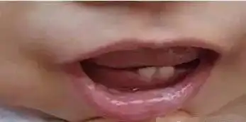  关于给宝宝口腔护理的常识,有这一篇就够了