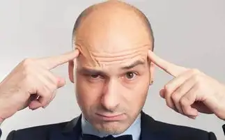  成功男士就该顶着个大秃头