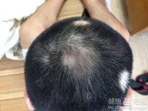 正月剪头搞笑图片女性斑