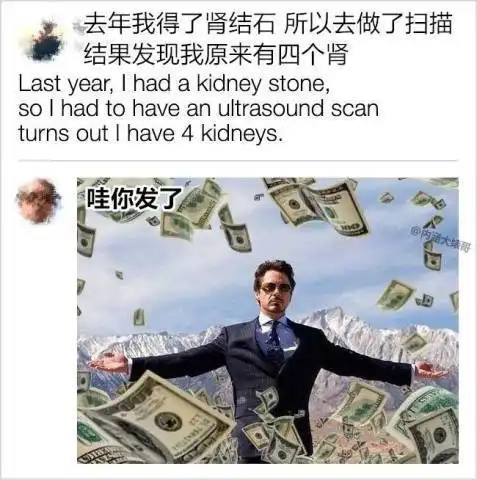 晒出你拍过最搞笑的照片,每一个都是经典哈哈哈哈笑得头都飞了