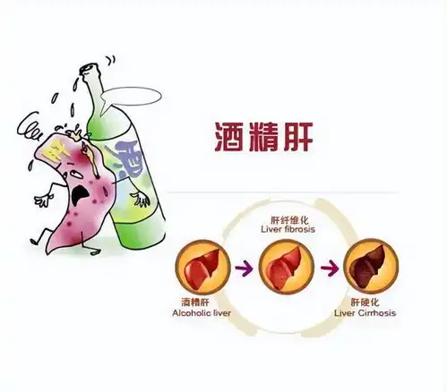  天天喝酒的人会得什么病研究发现经常喝酒最伤这2个器官